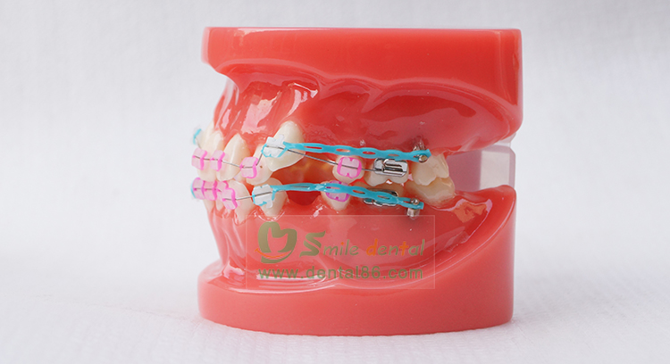 TM-B1-03 Orthodontic Model